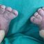 Россиянка родила третьего ребенка с 12 пальцами на ногах