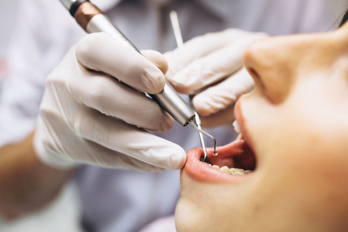 В российском городе планируют разрешить тратить маткапитал на стоматолога и офтальмолога