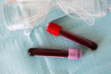 Ученые выяснили, люди с какой группой крови наиболее восприимчивы к COVID-19