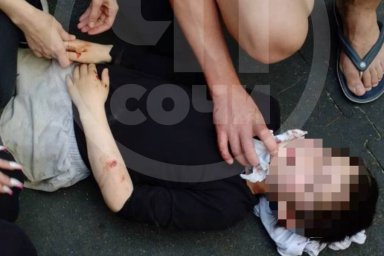 В Сочи мальчик сильно пострадал после нападения овчарки на детской площадке