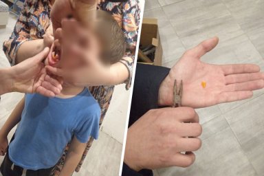 Спасатели сняли деталь от конструктора с зубов российского школьника