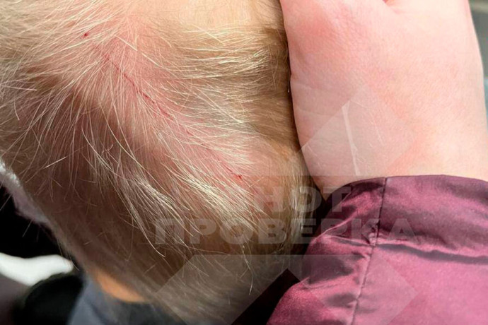 Ребенок расцарапал голову гвоздем из шапки в московском торговом центре