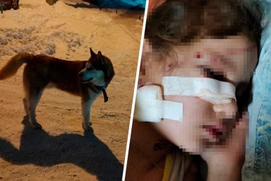 Потерявшая хозяина собака покусала девочку в Томске